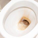 7 types of Toilet Infection: Symptoms, and Types